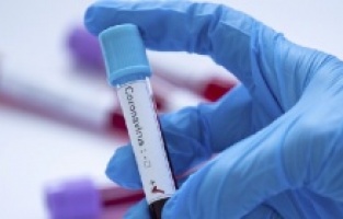 U svijetu više od 155 miliona oporavljenih od koronavirusa: U BiH pozitivno 80 osoba