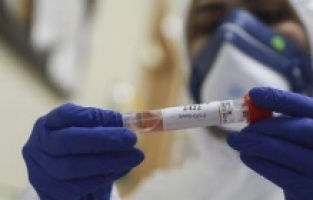 Otkriven prvi slučaj flurone u BiH