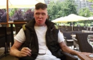 Aldin Jacić treba pomoć: Njegova jedina želja je da živi život poput svih ostalih mladića